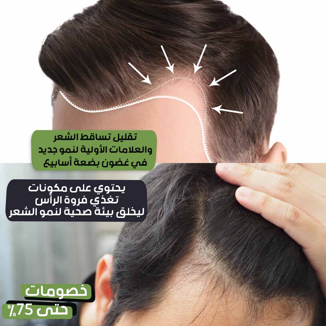 Hair-growth-spray-4